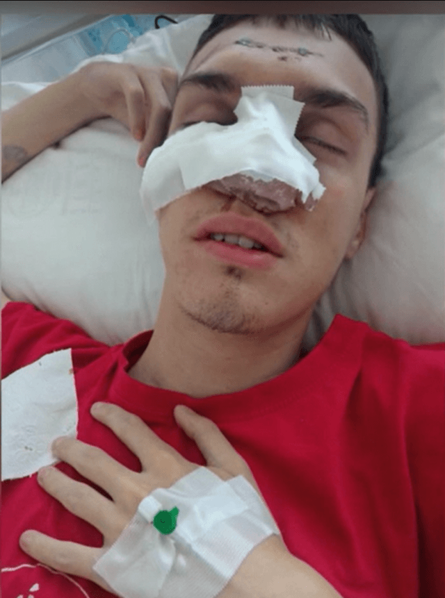 Teške povrede i mučenje studenta Luke Mihajlovića iz Zrenjanina